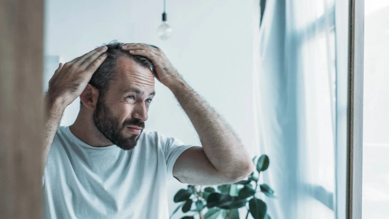 Couro cabeludo, calvície e caspa